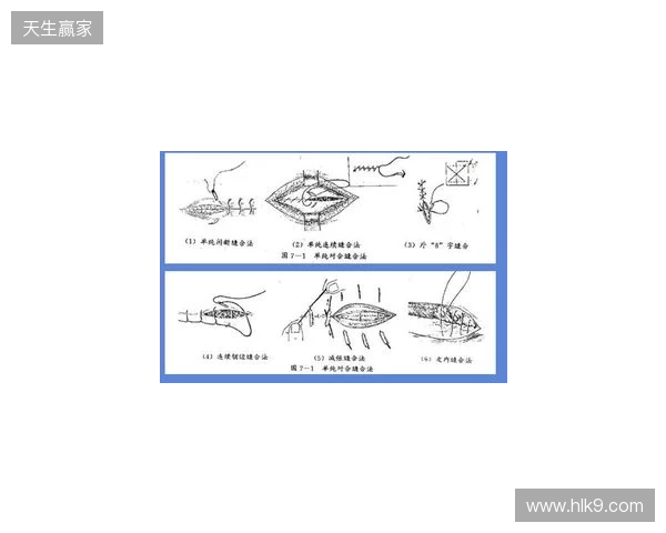 广州豹官方：杨浩眉弓伤口缝合30余针，预计5-7天后拆线